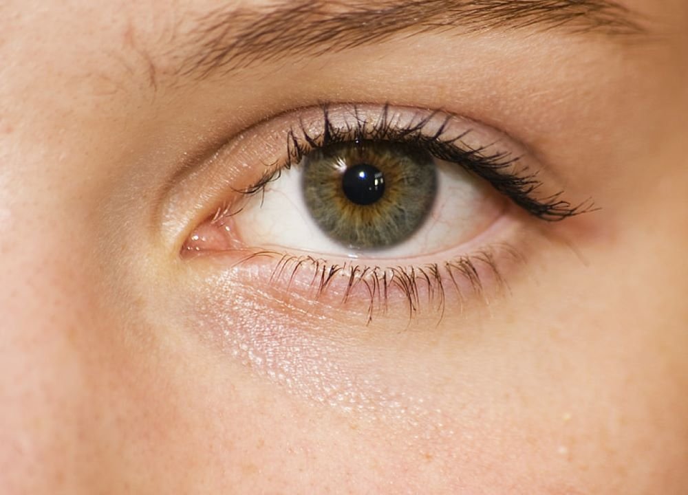 CONTACT LENSES GUID